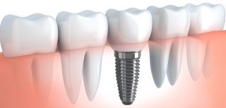 orthodontic dentists in charlotte Dental Wellness of Charlotte